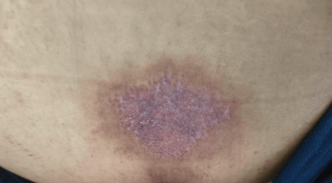 皇冠信用网怎么申请_14岁女孩在拓展营遭体罚去世皇冠信用网怎么申请，班主任因截留其给父母信件受审